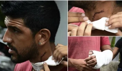 Reiner Hurtado, venezolano herido.