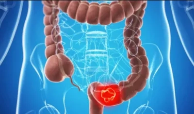  El estudio también podría allanar el camino para el desarrollo de nuevas terapias .