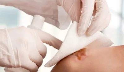 Podría aplicarse internamente en órganos afectados.