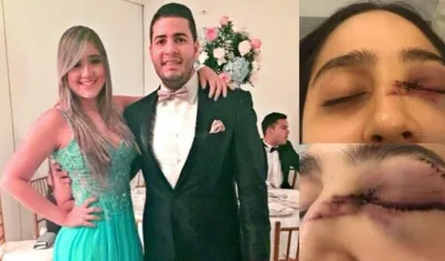 Daniela Ahumada Comas y Mateo Cabrera Urueta. Así quedó su rostro. 