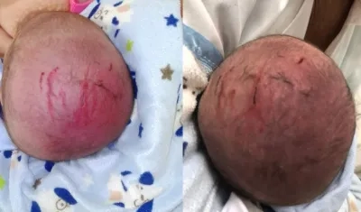 Así se ven las laceraciones en la cabeza del bebé. Las imágenes fuero autorizadas para su publicación por los padres de familia.