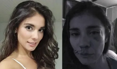 Así quedó el rostro de Eileen Moreno. 