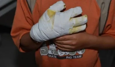 25 menores resultaron quemados con pólvora en Atlántico.