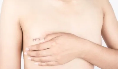 El cáncer es la principal causa de muerte en todo el mundo. 