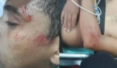 Así quedó el joven lesionado.