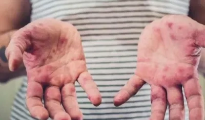 El número total de casos estimados en 2018 ascendió a 9,76 millones.