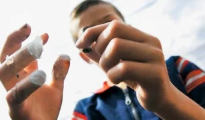 Cifra de quemados se disparó en Barranquilla.