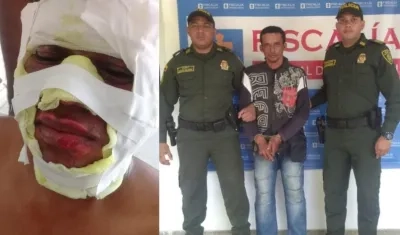 Uno de los policías quemados y el capturado.