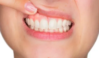 El lavado de los dientes después de comer es una de las recomendaciones de los odontólogos.