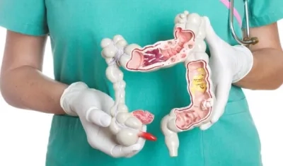 Este padecimiento es el segundo tipo de cáncer que cobra la vida de hombres y el tercero en mujeres.