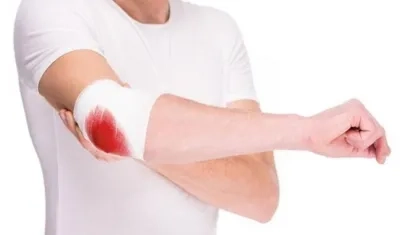 La hemofilia es una enfermedad hereditaria.