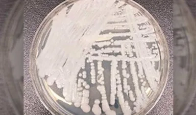 La Cándida auris apareció en 2015 y tiene vigilancia en Colombia desde el año 2016.