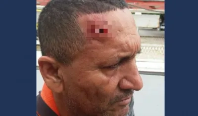 Así quedó la frente del contratista de Electricaribe, tras la agresión de la que fue objeto.