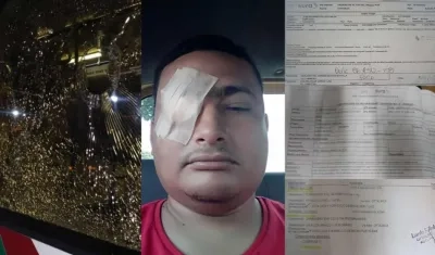 José Eduardo Collazo Mejía, el usuario que sufrió lesiones en su ojo derecho tras  el ataque a un busetón de Transmetro