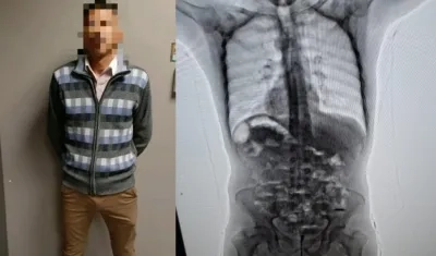 El capturado y la droga en su cuerpo.