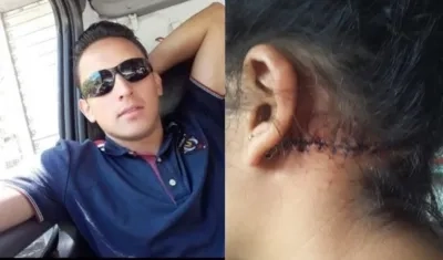  Edward Alexánder Porras Bohórquez agredió brutalmente a su exnovia.