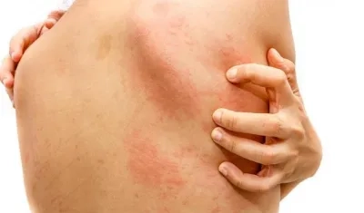 Quienes acudan a la jornada recibirán el diagnóstico y orientación gratis.