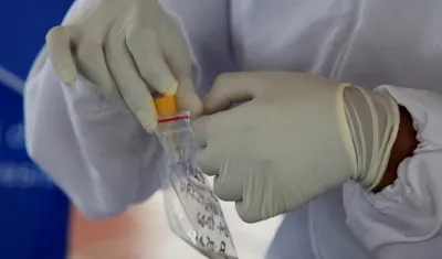 Un trabajador de la salud alista una prueba Covid-19 para procesarla.