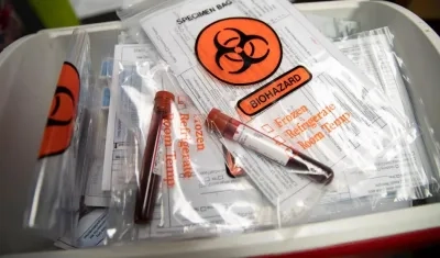 Muestras de sangre para exámenes para Covid-19. 