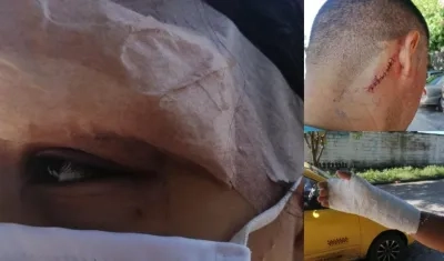 Familiares del soldado muerto resultaron golpeados. 