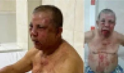 Con golpes en su cara quedó el comerciante Dagoberto Sierra en Luruaco.