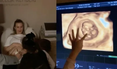 Momentos en que se le realiza una ecografía a Lorelei Tarón, esposa de Falcao García.