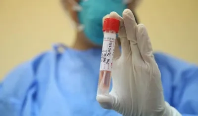 Deben garantizar la toma de muestra para los casos en que se requiera según cuadro clínico del paciente.