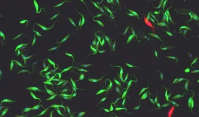 Imagen microscópica del parásito Trypanosoma cruzi que causa la enfermedad de Chagas.