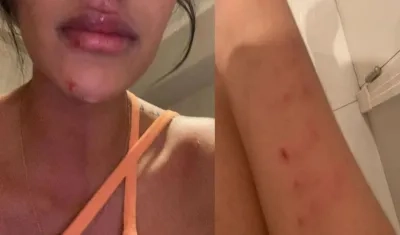 Daniela Cortés mostrando los efectos del maltrato físico.