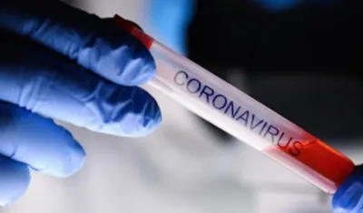 Casos en el país aumentaron.