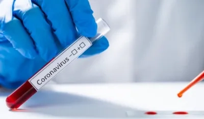 Entidad está preocupada por pruebas a afiliados de las EPS.