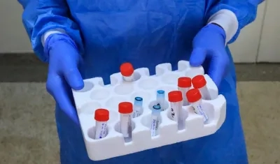 Más de la mitad de los países de África están experimentando la transmisión comunitaria de la Covid-19.