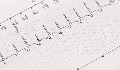 Así lo revela un estudio de la Escuela de Medicina Perelman de la Universidad de Pensilvania (Estados Unidos).