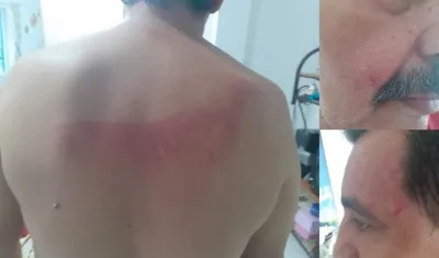 Agresión a uno de los hombres.