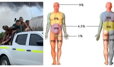 Parte de los heridos. 