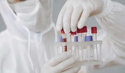 Según estudios, el virus puede dejar secuelas.