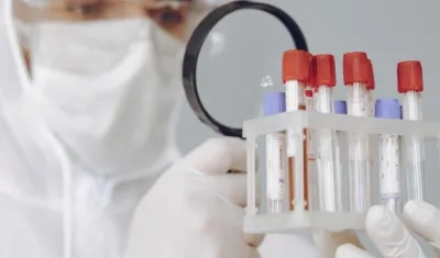 Pruebas moleculares RT-PCR, pruebas de antígeno y pruebas serológicas para el Covid-19