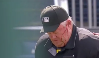 El árbitro de Grandes Ligas Joe West, herido en la cabeza.