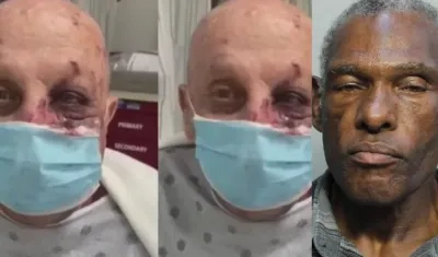 Eduardo Fernández y el agresor Robert Lee Ribbs.