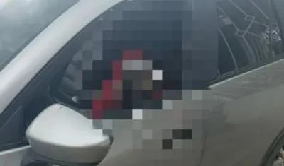 Jhon Fredy Amador Miranda, tras el ataque a bala.