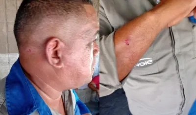 El operario resultó herido en su cabeza y en uno de sus brazos. 