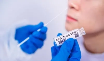 Pruebas disminuyeron igual que los casos reportados.