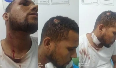 El árbitro Arlinton Ariza mostrando las violentas heridas recibidas.