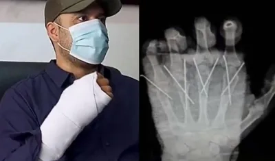 Al policía lograron reimplantarle la mano amputada. 