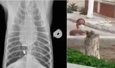 Imagen de la radiografía de la veterinaria donde fue atendido el caso. En la otra foto el infractor.