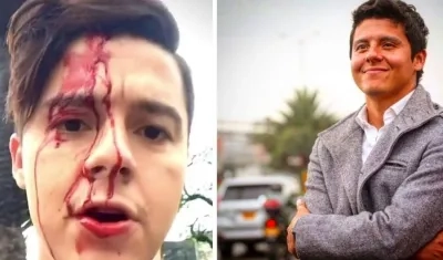 Así quedó el actor tras el ataque.