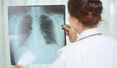 Colombia es el quinto país de la región con mayor carga de casos de tuberculosis.