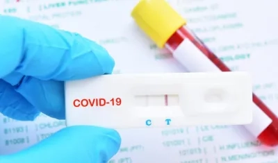 La prueba es con prescripción médica.