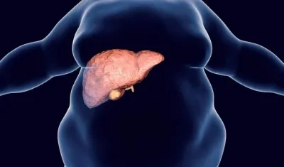 El sobrepeso y sedentarismo en la infancia inciden en que desde edades tempranas se pueda acumular grasa en el hígado.