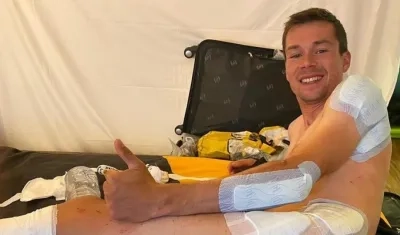 Primoz Roglic muestra sus heridas. 